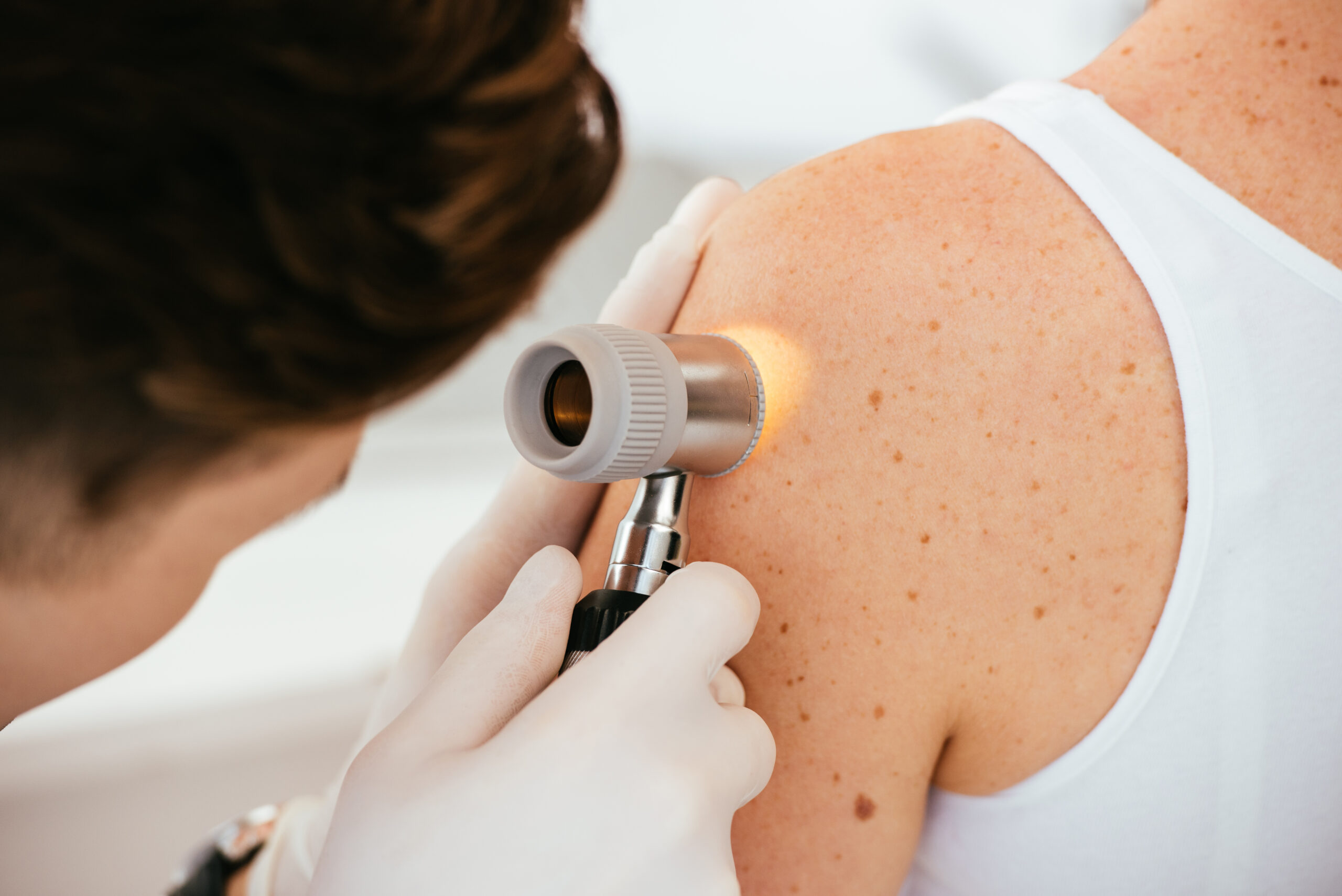 cropped view of dermatologist in latex gloves holding dermatosco